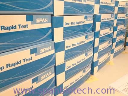 Essai du virus ab d'influenza aviaire